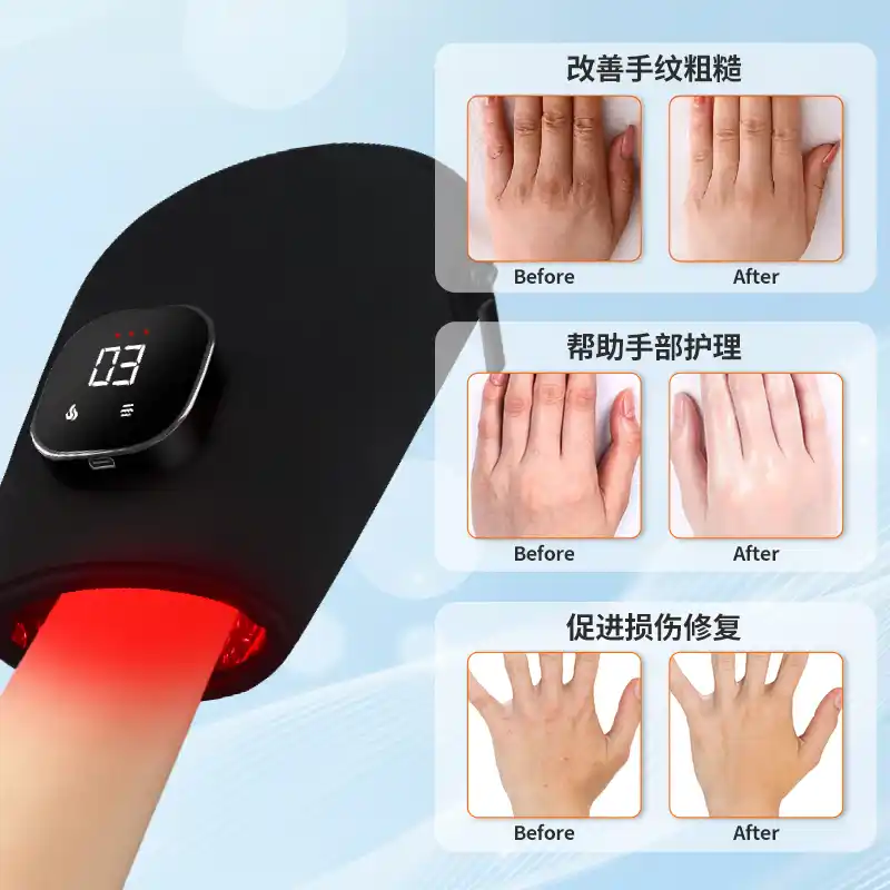 LED red light therapy gloves for hand recovery